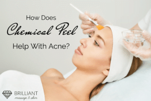 girl having a chemical peel applied using a yellow brush:text: how does chemical peel help with acne?