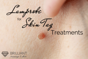 skin tag: text: lamprobe for skin tag treatments