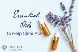 Essential oils in a bottle and some lavender flower; text essential oils to help clear acne