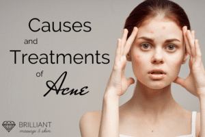 teen girl having acne breakouts: text: causes and treatments of acne