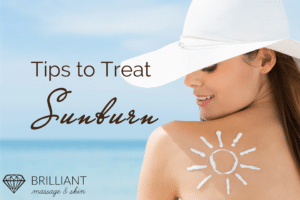 girl in wide brim hat with sun drawn on her back using sunscreen: text: tips to treat sunburn
