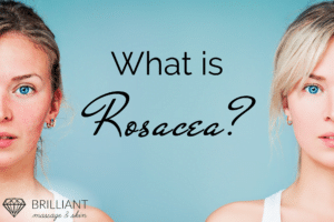 half-faced teens, one with red skinned face while one with clear white skin: text: What is rosacea?